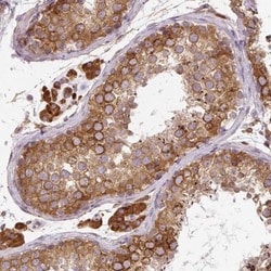 CYP20A1 Antibody, Novus Biologicals 25 &mu;L, Unlabeled:Antibodies, Polyclonal